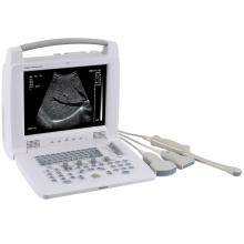 12 Inch Medical Equipment Full Digital Portable Physiotherapy Ultrasound Machine Black/white Electric Ce Free Spare Parts CE ISO